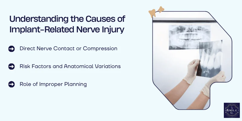 Common Causes of Nerve Injury During Implant Placement