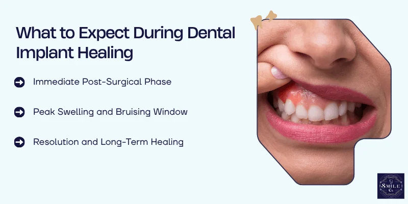 Dental Implant Healing Timeline and Stages