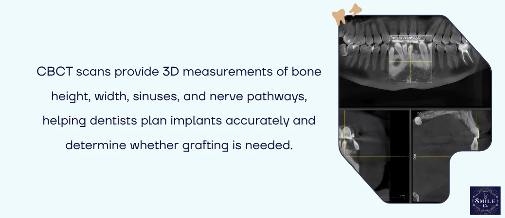 How CBCT Scans and 3D Imaging Guide the Decision