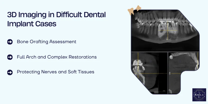 Managing Challenging Cases With 3D Scanning