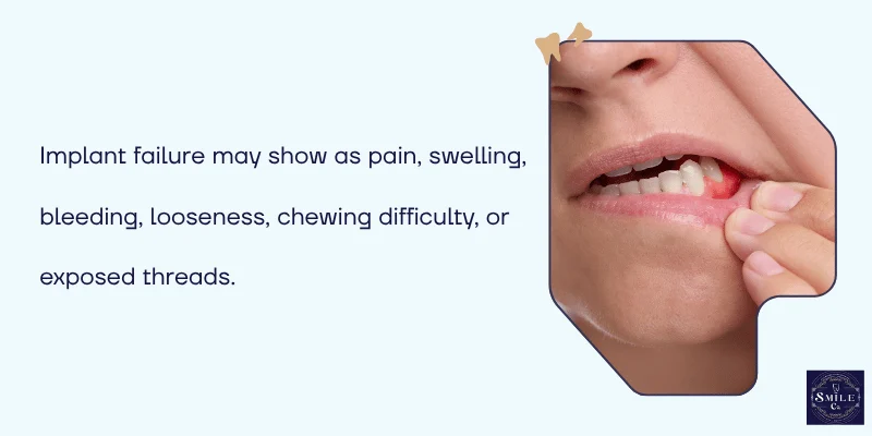 Signs and Symptoms of Implant Failure