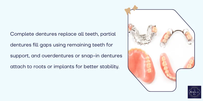 Types of Dentures Complete, Partial, and Overdentures