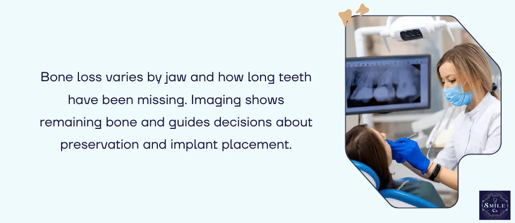 Why Bone Loss Does Not Affect Every Jaw the Same Way