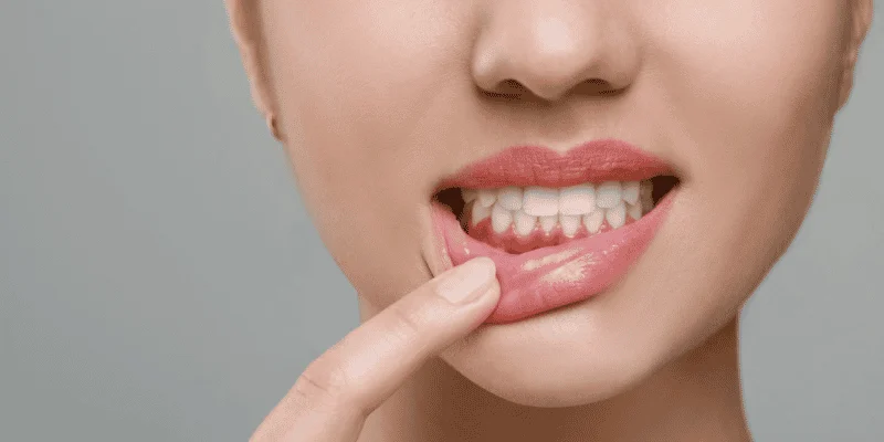 gum disease and dental implants