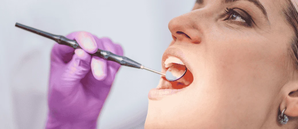 pterygoid implants for upper jaw bone loss