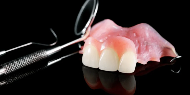temporary teeth during implant treatment